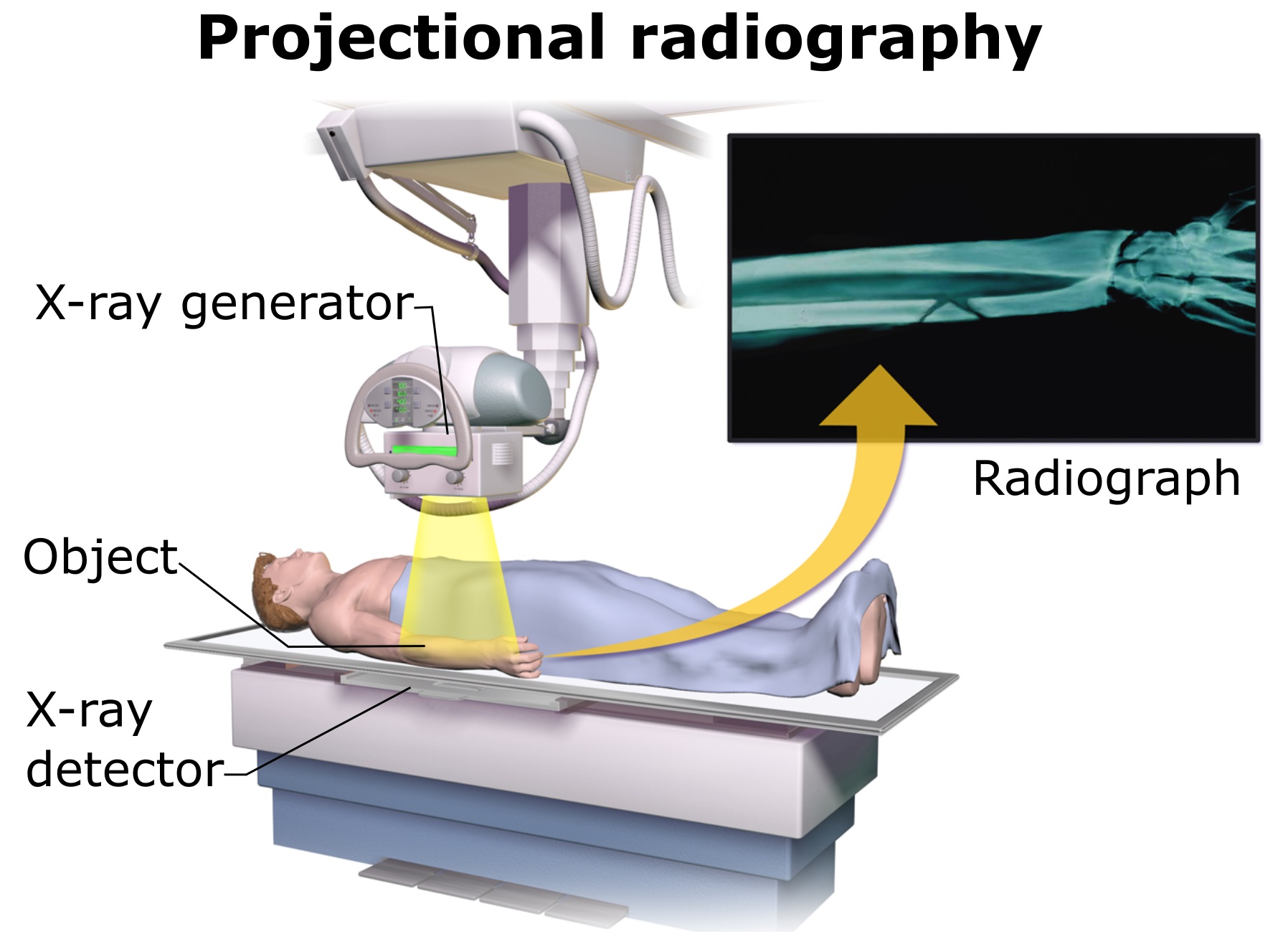 Röntgen Cihazı Nedir?Çalışma Prensipleri Nedir?